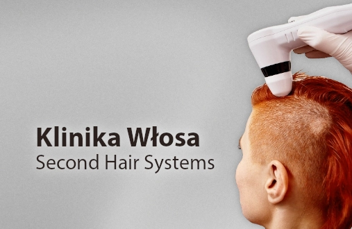 SecondHair Systems